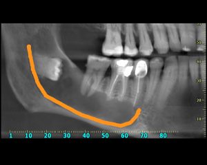 Ακτινογραφία | oralradiology.gr
