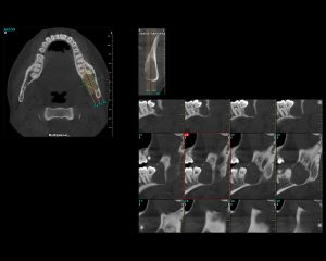 Multiplanar | oralradiology.gr
