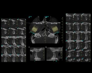 ΟΒΕΛΙΑΙΕΣ ΤΟΜΕΣ | oralradiology.gr