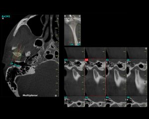 Multiplanar | oralradiology.gr