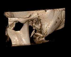 Κρανίο | oralradiology.gr