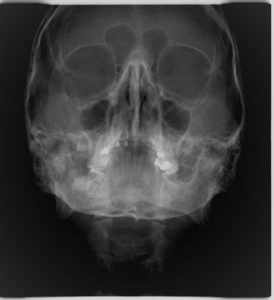 WATERS Οδοντιατρική Ακτινοδιάγνωση Χαλκίδα