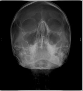 WATERS Οδοντιατρική Ακτινοδιάγνωση Χαλκίδα