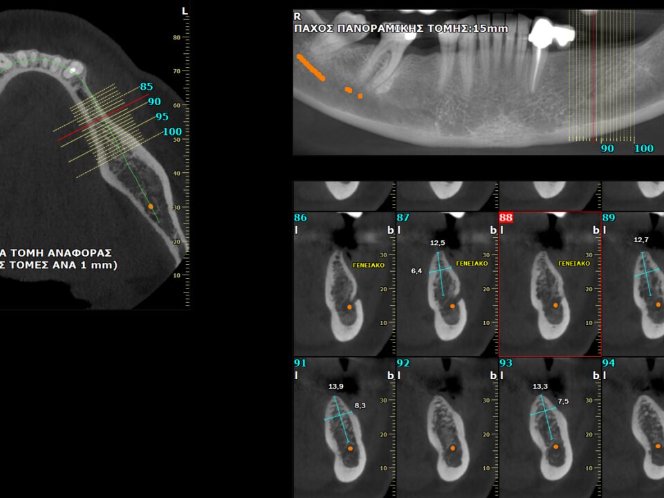 Γενικά CBCT Οδοντιατρική Ακτινοδιάγνωση Χαλκίδα